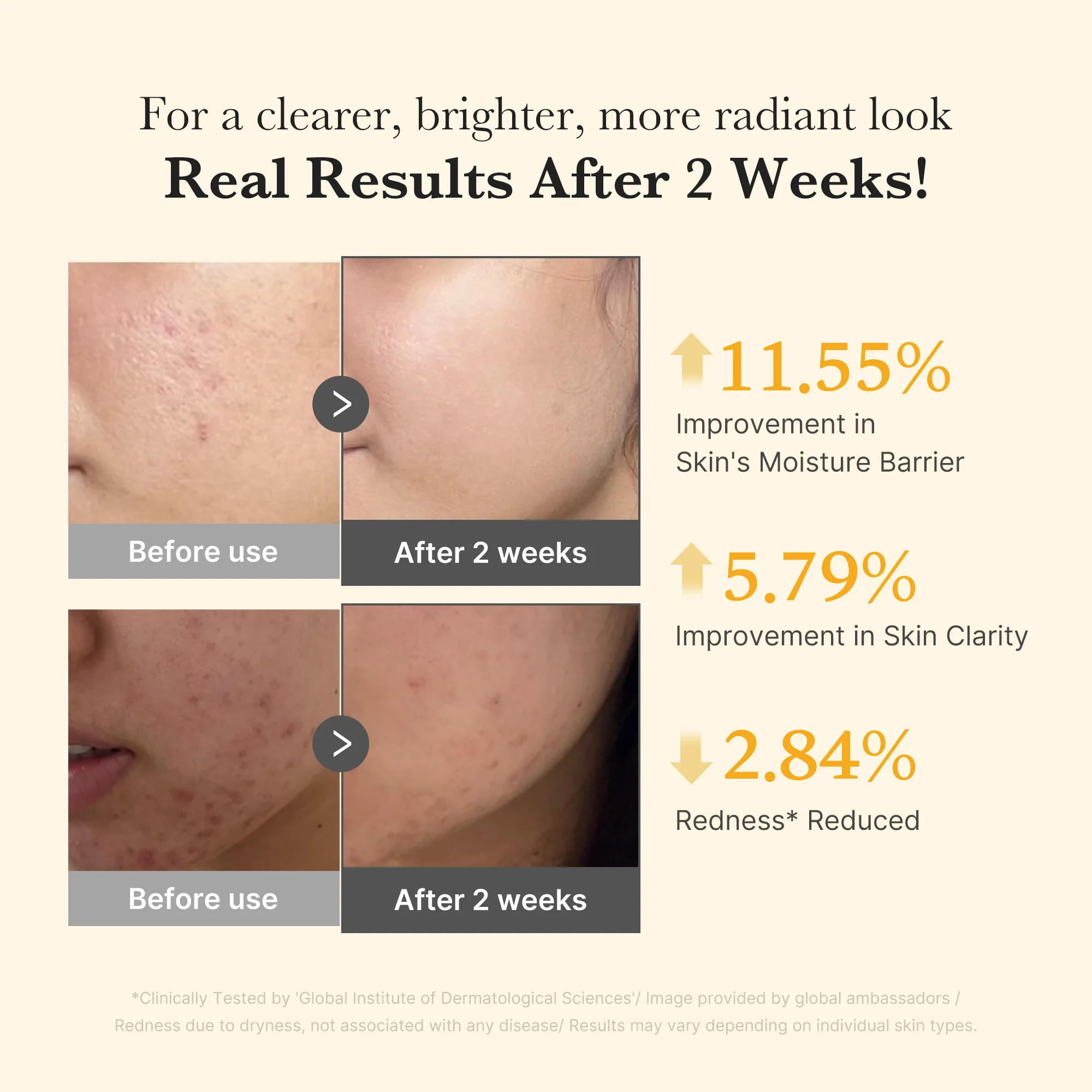 [Subscr.] Kojic Acid Turmeric Capsule Serum - Image 4