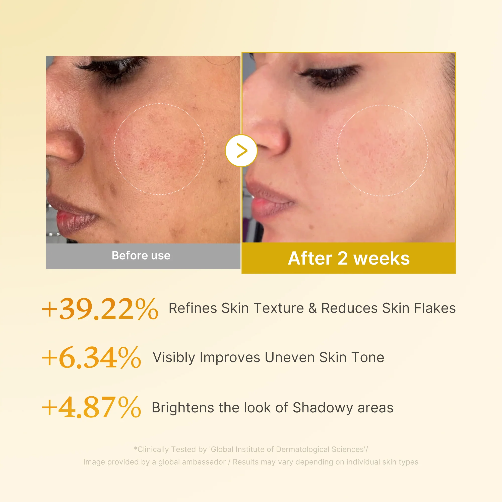 [GIFT] Kojic Acid Turmeric Toner - Image 4