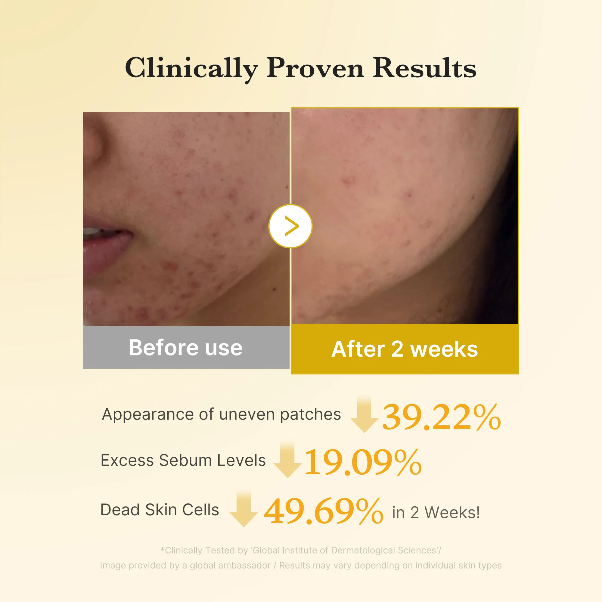 [GIFT] Kojic Acid Tumeric Toner Pad - Image 4
